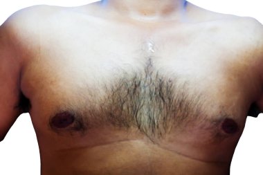 Adamın göğsü ve midesi kıllı.