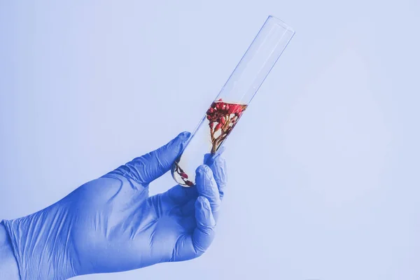 Ręka Holed małe rośliny w probówce dla biotechnologii Medicin — Zdjęcie stockowe