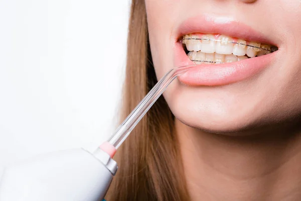 Seorang gadis dengan kawat gigi di giginya menarik bibir bawahnya dengan irrigator untuk benar-benar mencuci mulutnya — Stok Foto