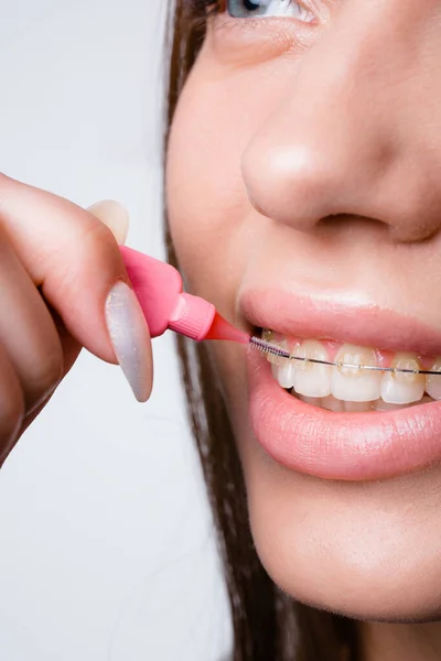Foto vertikal seorang gadis membersihkan kawat gigi dan gigi dengan sikat mulut merah muda — Stok Foto
