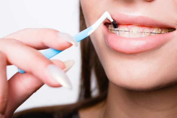 Tembakan dekat mulut dan bibir gadis-gadis dengan kawat gigi, yang ia sikat dengan sikat gigi untuk mencegah kerusakan gigi — Stok Foto