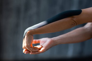 Dirseğinden bileğine kadar yapıştırılmış bir alçıyla kadın eli Kinezi ve yaralardan sonra rehabilitasyon için