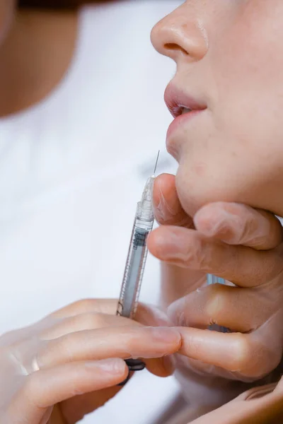 Крупный план рук врача косметолога с помощью шприца для инъекций возле губ девушки. — стоковое фото