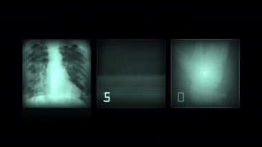 Siyah arka planda X-ray bilgisayar animasyonu konsepti. 4K çözünürlüğü.