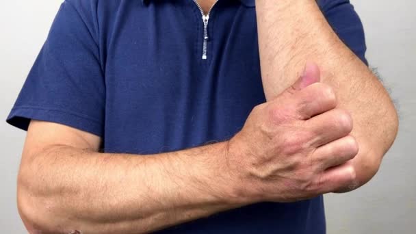 Dita di un vecchio con psoriasi ed eczema. Un primo piano del peeling cutaneo — Video Stock