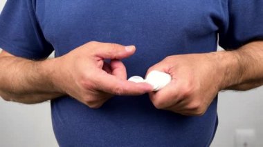 Adam krem parmağını üzerinde olabilir alır. Sedef hastayla elleri. Dermatit.