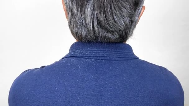 Close-up view of a man who has a lot of dandruff from his hair on his shirt and shoulders. — Stock Video