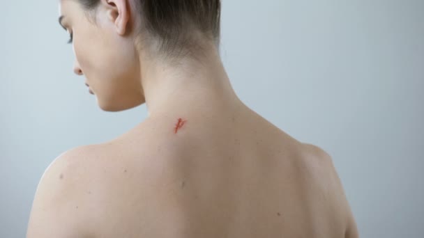 Терапевт исследует рану на спине женщины, используя увеличительное стекло, заживление шрамов — стоковое видео
