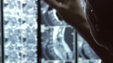 Dikkatle seyir profesyonel cerrah kontrol görüntü, tarama omurga yaralı