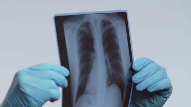 Manos del neumólogo que sostiene la radiografía pulmonar, la resonancia magnética y la atención médica, bronquitis — Vídeo de stock