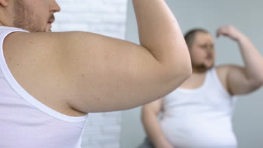 Üzgün obez lisans kontrol kolu sarkma cilt, sedanter yaşam tarzı, streç işaretleri