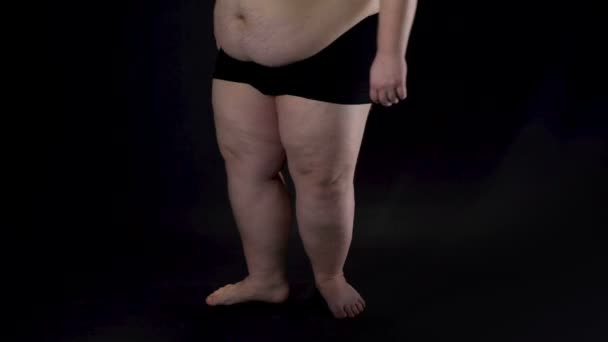 Obese mannelijke benen op donkere achtergrond, gezondheidsproblemen, onzekerheden, ziekte — Stockvideo