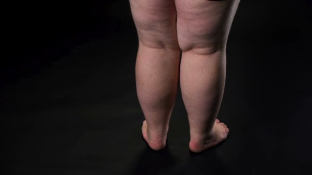 Piernas gordas masculinas con piel flácida y celulitis, ingesta excesiva de alimentos cuidado de la salud — Vídeo de stock