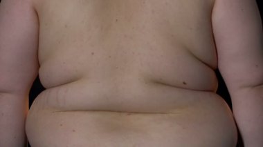 Etkisi overeating bel şişman kıvrımları, ağırlık kaybı zorluklar, obez adam üzgün