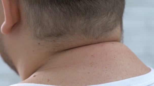 Хворий чоловік, який страждає від болю в шиї, ортопедичні захворювання, проблеми зі здоров'ям хребта — стокове відео