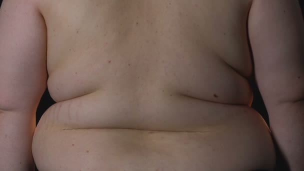 Übergewichtiger männlicher Körper auf schwarzem Hintergrund, Dehnungsstreifen und Cellulite, Fettleibigkeit — Stockvideo