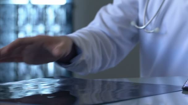 Хирург, осматривающий кости пациентов рентген, травму колена, воспаление суставов, здоровье — стоковое видео