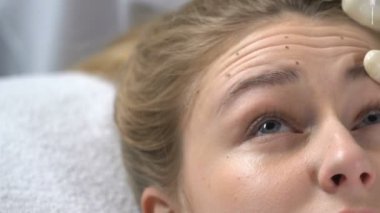 Şevval özçelik güzellik kadın alın kırışıklık, kusurları hyaluronik sıvı enjekte