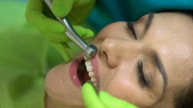 Orta kesici diş parlatma dişçi Diş dolgu macunu yerleşim closeup için hazırlanıyor