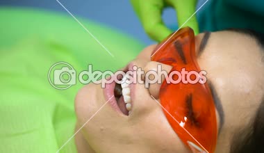 Diş kür ışık kullanılan diş tedavi, modern ekipman, işlemi kapatmak için