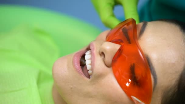 歯の治療、近代的な設備、プロセスのクローズ アップに使用する歯科硬化光 — ストック動画