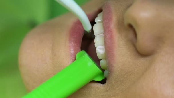 Restos de lavado médico del sello de los dientes de los pacientes con herramienta de agua, tratamiento — Vídeo de stock