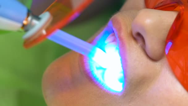Стоматолог сушит пломбу на зубах с свинцовым освещением, завершающий этап лечения — стоковое видео