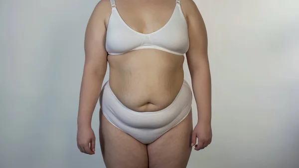 Poz Fotoğraf Makinesi Obezite Sağlıksız Beslenme Için Çamaşırı Giyen Kadın — Stok fotoğraf