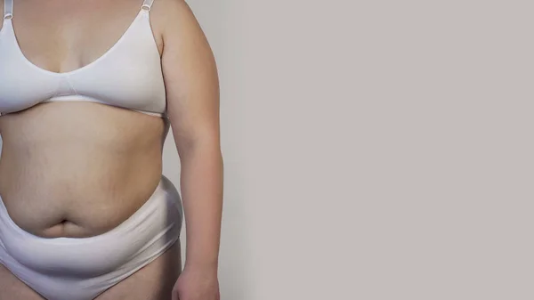 Mujer Con Sobrepeso Usando Lencería Delante Cámara Estadísticas Liposucción —  Fotos de Stock
