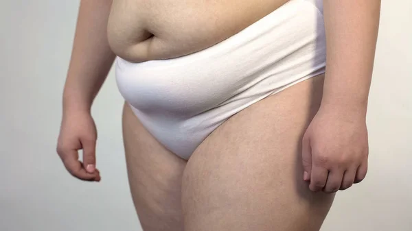 Fechar Barriga Flácida Quadris Mulher Com Sobrepeso Fêmea Gorda Cuidados — Fotografia de Stock