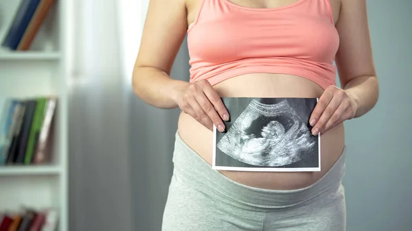 Kobieta Trzyma Obraz Usg Dziecka Ciesząc Się Zdrowej Ciąży Medycyna — Zdjęcie stockowe