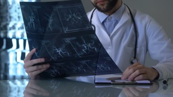 Neurocirujano Mirando Radiografía Los Vasos Cerebrales Tomando Notas Forma Médica — Vídeos de Stock