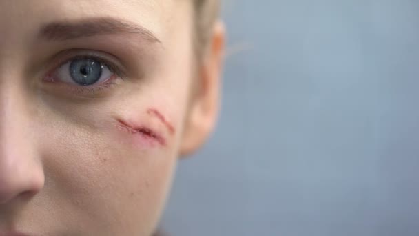 她脸上有伤痕的手无寸铁的女性看着镜头 家庭暴力 — 图库视频影像