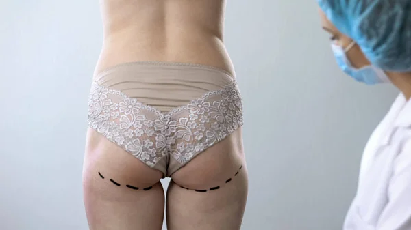 女性の尻の線を描画する外科医 美容整形手術のための準備 — ストック写真