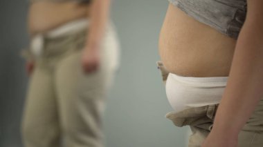 Streç işaretleri ile kadın belly fat, obezite nedeniyle dar pantolon düğmesi olamaz