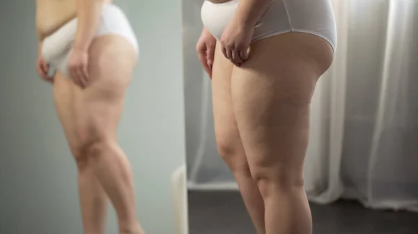 肥胖夫人臀部反射在镜子 脂肪团和舒展标记在皮肤 — 图库照片
