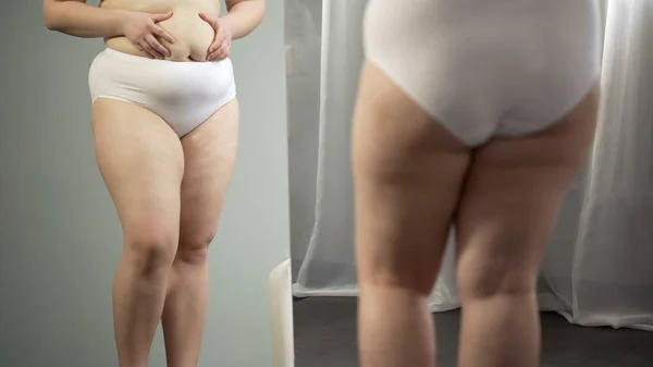 Fettleibige Dame Spiegel Cellulite Und Dehnungsstreifen Hüften Und Dickem Bauch — Stockfoto