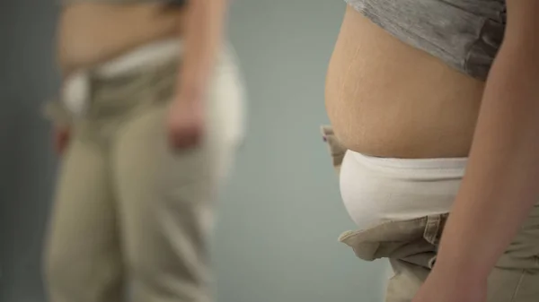 Vet Van Vrouwelijke Buik Met Striae Strakke Broek Als Gevolg — Stockfoto