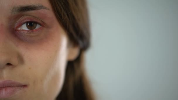Sad Lady Bruised Face Looking Camera Violence Gender Discrimination — Stock Video