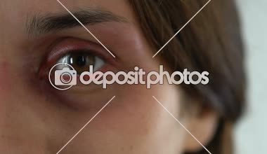 Çürük üzgün kadın göz, Aile içi şiddet kurbanı yakın çekim dehşete yüzü