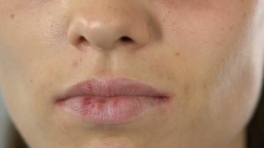 Çaresiz kadın ağlıyor, Aile içi şiddet kurbanı, kötüye farkındalık yüz bereli