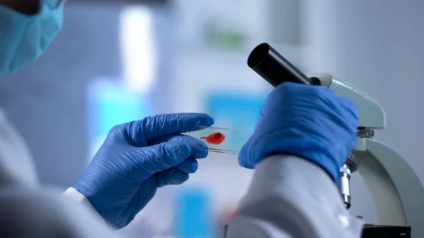 Aids Τσεκάπ Ερευνητής Ετοιμάζεται Εξετάσει Δείγμα Αίματος Κάτω Από Μικροσκόπιο — Φωτογραφία Αρχείου