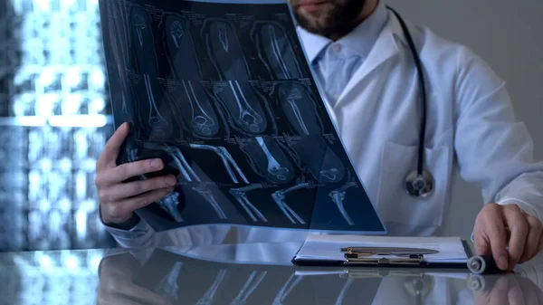 Чоловічий Травматолог Який Дивиться Рентгенівський Знімок Ноги Пацієнта Діагностична Проблема — стокове фото