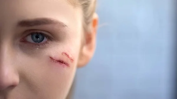 Mujer Joven Con Profundas Cicatrices Cara Llorando Mirando Cámara Cerca — Foto de Stock