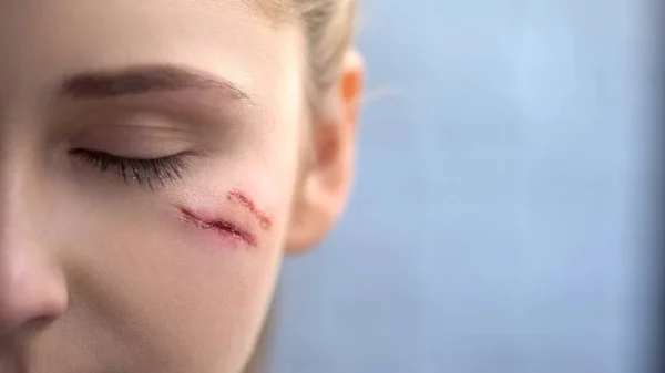与深部伤疤 家庭暴力受害者 痛苦的年轻女性脸部亲密接触 — 图库照片