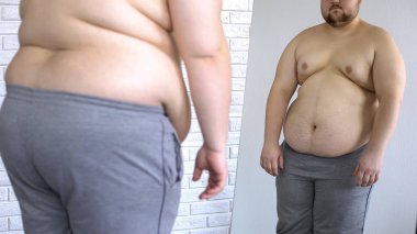 Obez adam--dan göbek aşırı kilo, acı bir sağlık sorunu aynaya bakmak