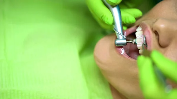 Стоматолог Полирующий Зубы Пациенток Защита Полости Рта Крупным Планом — стоковое фото