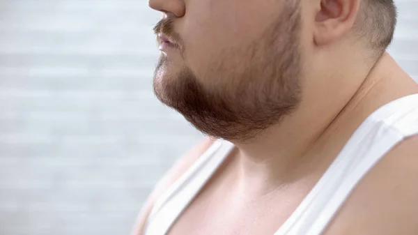 Крупный План Жирного Бородатого Мужчины Белой Рубашке Проблемы Ожирением Отсутствие — стоковое фото