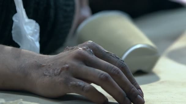 Hand Hand Zwischen Abfall Opfer Eines Biowaffenangriffs Ansteckende Infektion — Stockvideo