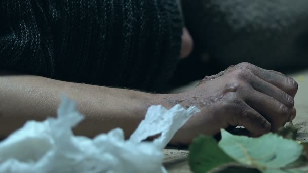无家可归的人在垃圾中冷冻 手上有传染性不治之症的伤口 — 图库视频影像